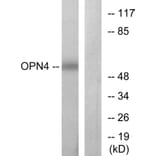 Western Blot - Anti-OPN4 Antibody (G488) - Antibodies.com