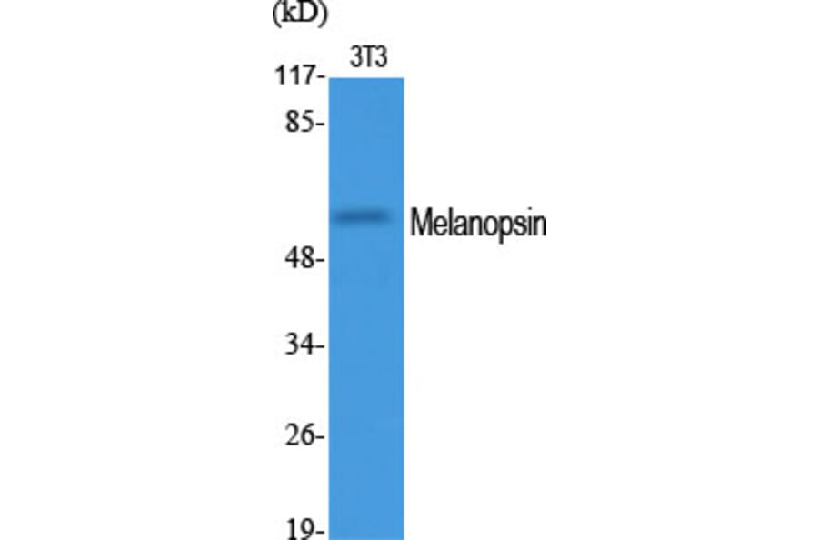 Western Blot - Anti-OPN4 Antibody (G488) - Antibodies.com