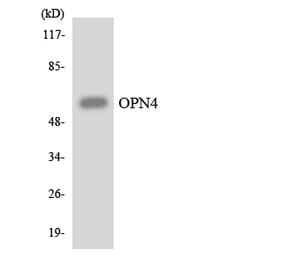 Western Blot - Anti-OPN4 Antibody (R12-3120) - Antibodies.com