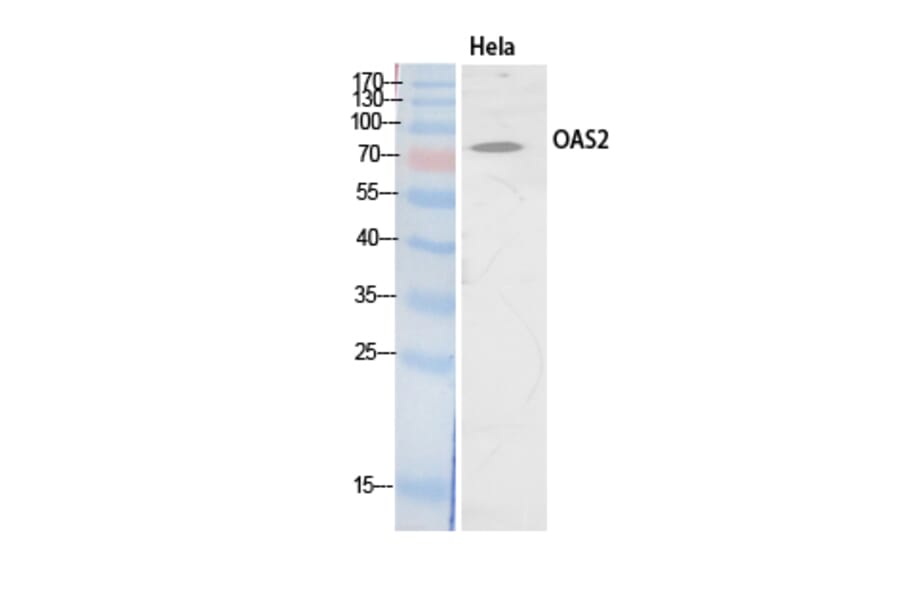 Western Blot - Anti-OAS2 Antibody (C30992) - Antibodies.com