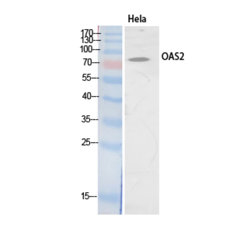 Western Blot - Anti-OAS2 Antibody (C30992) - Antibodies.com