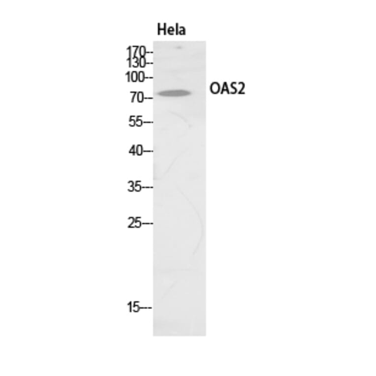 Western Blot - Anti-OAS2 Antibody (C30992) - Antibodies.com