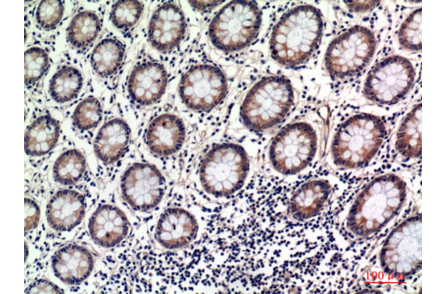 Immunohistochemistry - Anti-OAS2 Antibody (C30992) - Antibodies.com