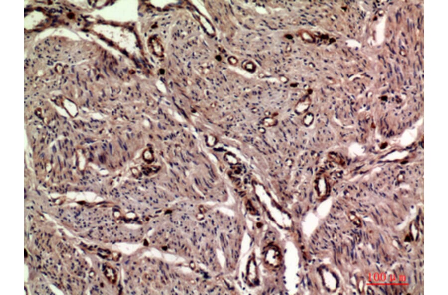 Immunohistochemistry - Anti-OAS2 Antibody (C30992) - Antibodies.com