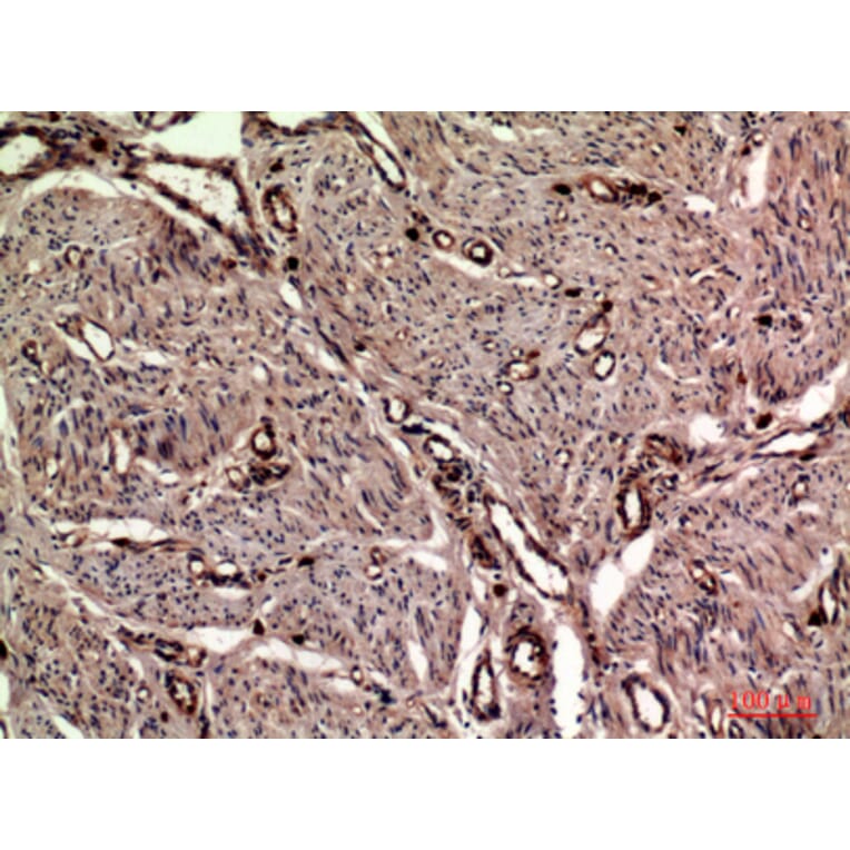 Immunohistochemistry - Anti-OAS2 Antibody (C30992) - Antibodies.com