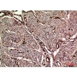 Immunohistochemistry - Anti-OAS2 Antibody (C30992) - Antibodies.com