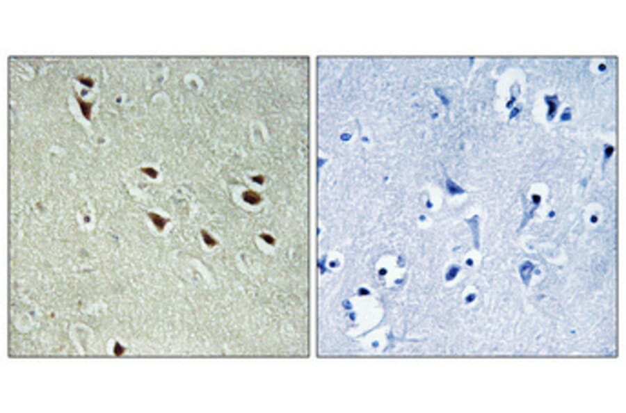Immunohistochemistry - Anti-NXF3 Antibody (C17132) - Antibodies.com