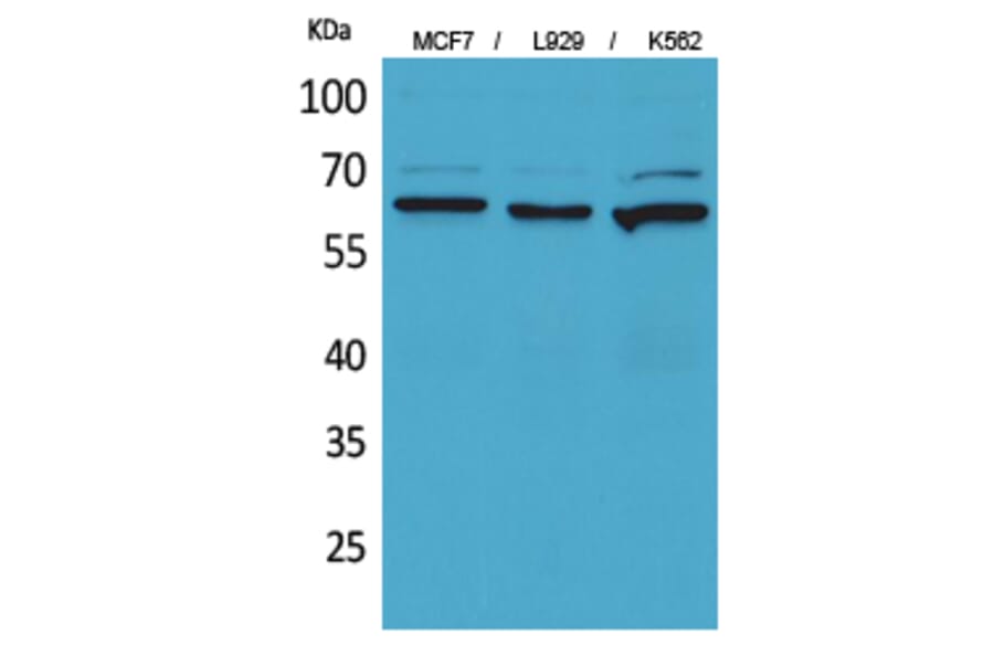 Western Blot - Anti-NT5E Antibody (C30382) - Antibodies.com