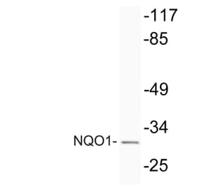 Western Blot - Anti-NQO1 Antibody (R12-2274) - Antibodies.com