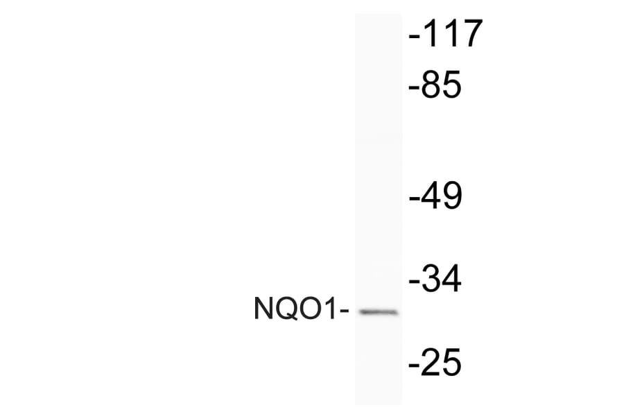 Western Blot - Anti-NQO1 Antibody (R12-2274) - Antibodies.com