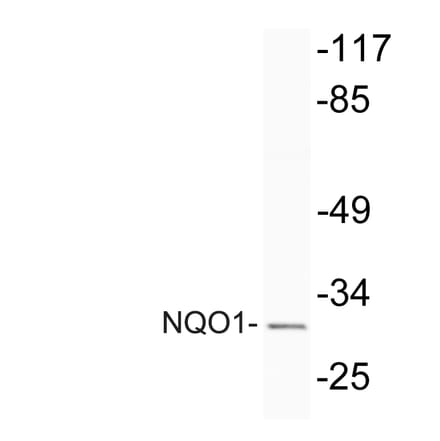 Western Blot - Anti-NQO1 Antibody (R12-2274) - Antibodies.com