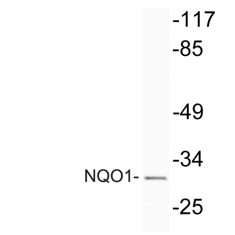 Western Blot - Anti-NQO1 Antibody (R12-2274) - Antibodies.com