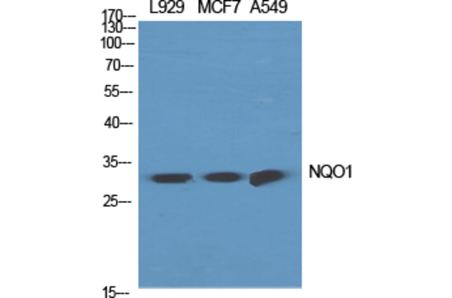 Western Blot - Anti-NQO1 Antibody (R12-2274) - Antibodies.com