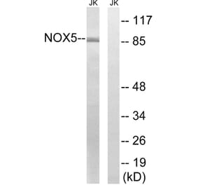 Western Blot - Anti-NOX5 Antibody (C16867) - Antibodies.com