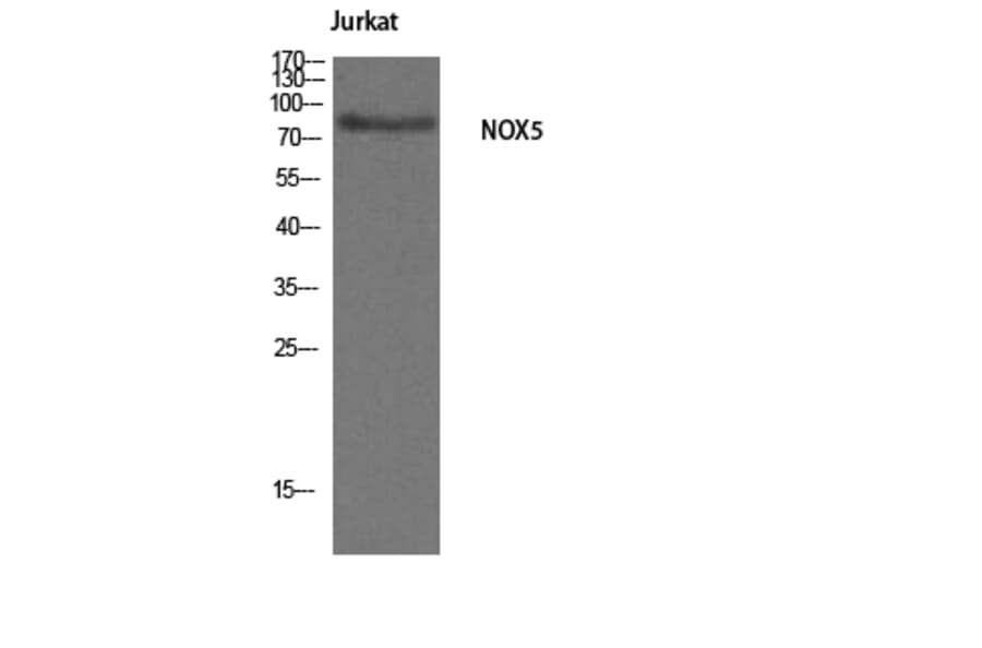 Western Blot - Anti-NOX5 Antibody (C16867) - Antibodies.com