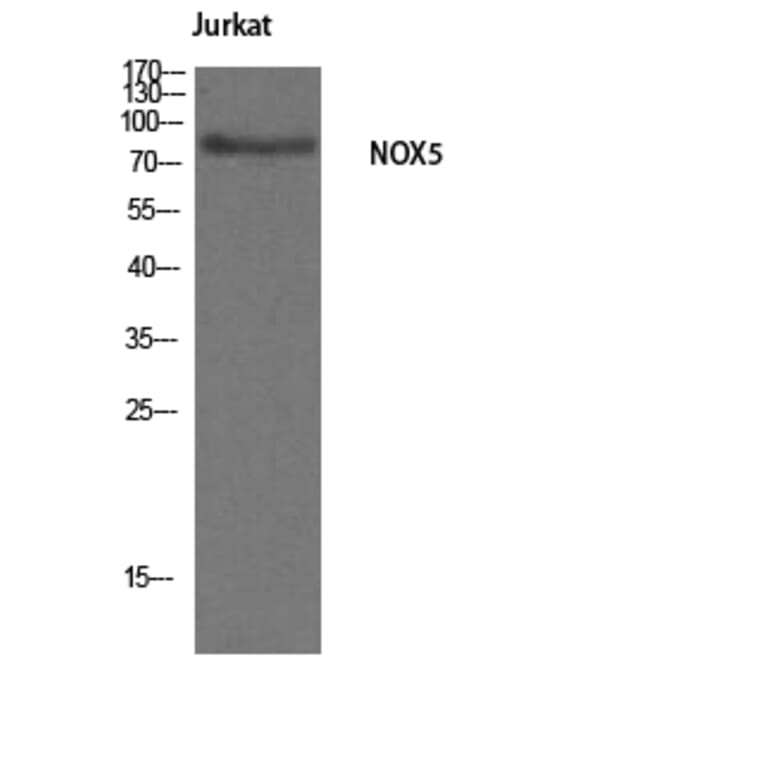 Western Blot - Anti-NOX5 Antibody (C16867) - Antibodies.com