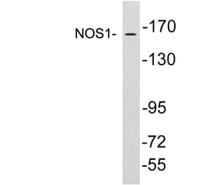 Western Blot - Anti-NOS1 Antibody (R12-2271) - Antibodies.com