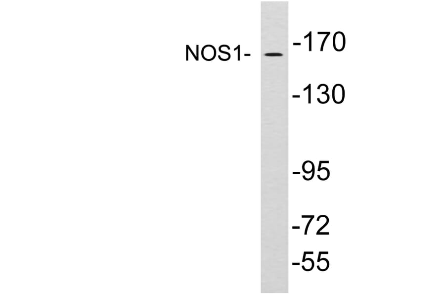 Western Blot - Anti-NOS1 Antibody (R12-2271) - Antibodies.com