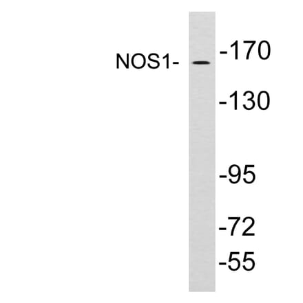 Western Blot - Anti-NOS1 Antibody (R12-2271) - Antibodies.com