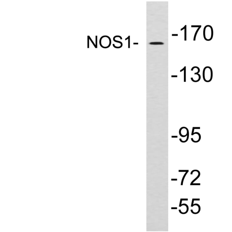 Western Blot - Anti-NOS1 Antibody (R12-2271) - Antibodies.com