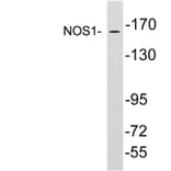 Western Blot - Anti-NOS1 Antibody (R12-2271) - Antibodies.com