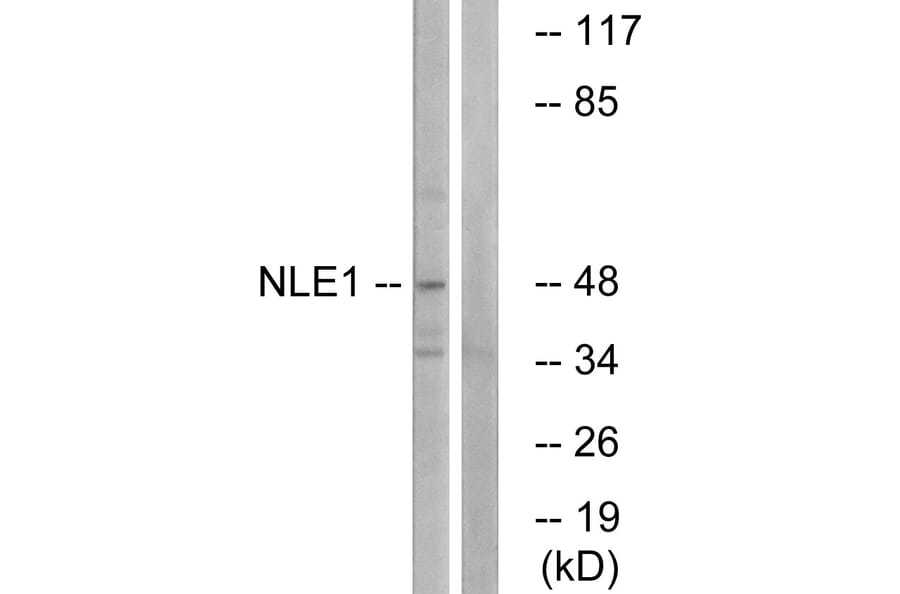 Western Blot - Anti-NLE1 Antibody (C17064) - Antibodies.com