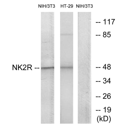 Western Blot - Anti-NK2R Antibody (G403) - Antibodies.com