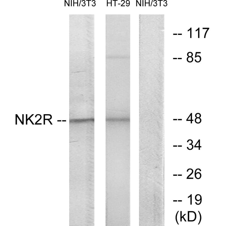 Western Blot - Anti-NK2R Antibody (G403) - Antibodies.com