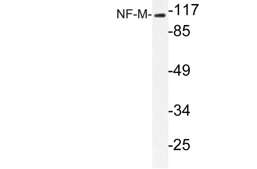 Western Blot - Anti-NF-M Antibody (R12-2263) - Antibodies.com