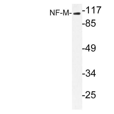 Western Blot - Anti-NF-M Antibody (R12-2263) - Antibodies.com