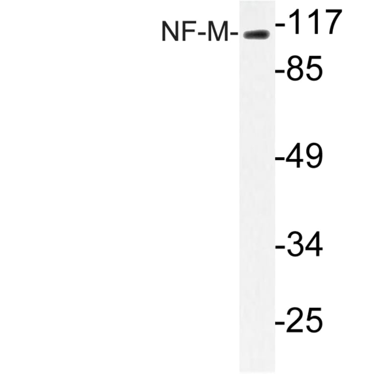 Western Blot - Anti-NF-M Antibody (R12-2263) - Antibodies.com