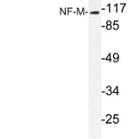 Western Blot - Anti-NF-M Antibody (R12-2263) - Antibodies.com