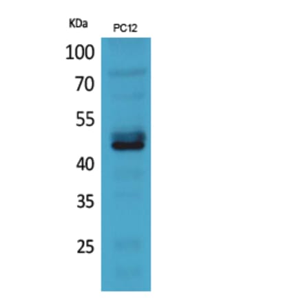 Western Blot - Anti-NCR2 Antibody (C30558) - Antibodies.com