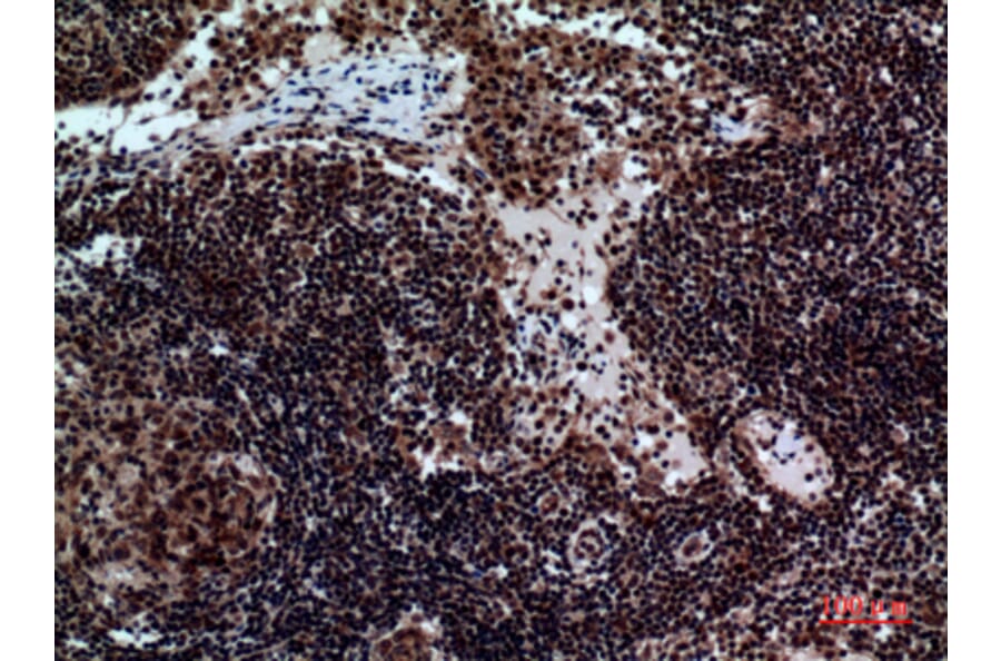 Immunohistochemistry - Anti-NCR2 Antibody (C30558) - Antibodies.com