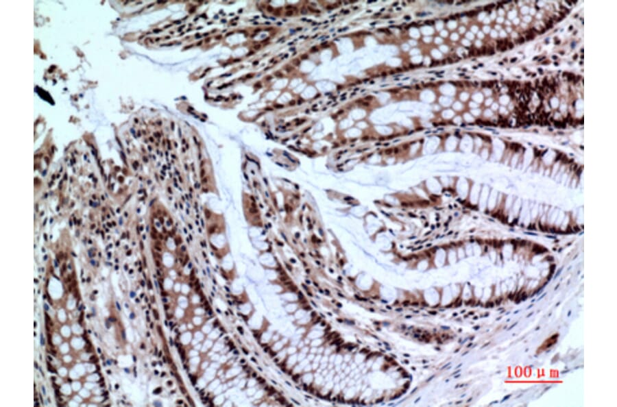 Immunohistochemistry - Anti-NCR2 Antibody (C30558) - Antibodies.com