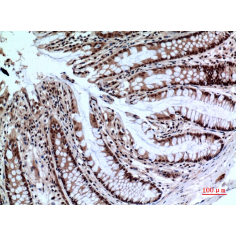 Immunohistochemistry - Anti-NCR2 Antibody (C30558) - Antibodies.com