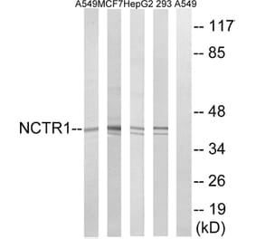 Western Blot - Anti-NCR1 Antibody (C16873) - Antibodies.com
