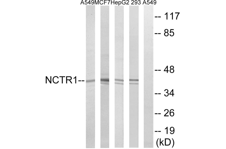 Western Blot - Anti-NCR1 Antibody (C16873) - Antibodies.com