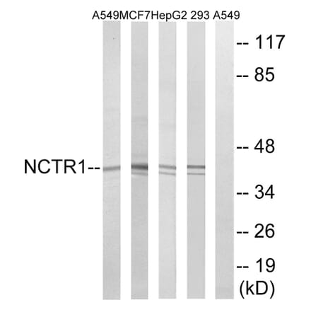 Western Blot - Anti-NCR1 Antibody (C16873) - Antibodies.com