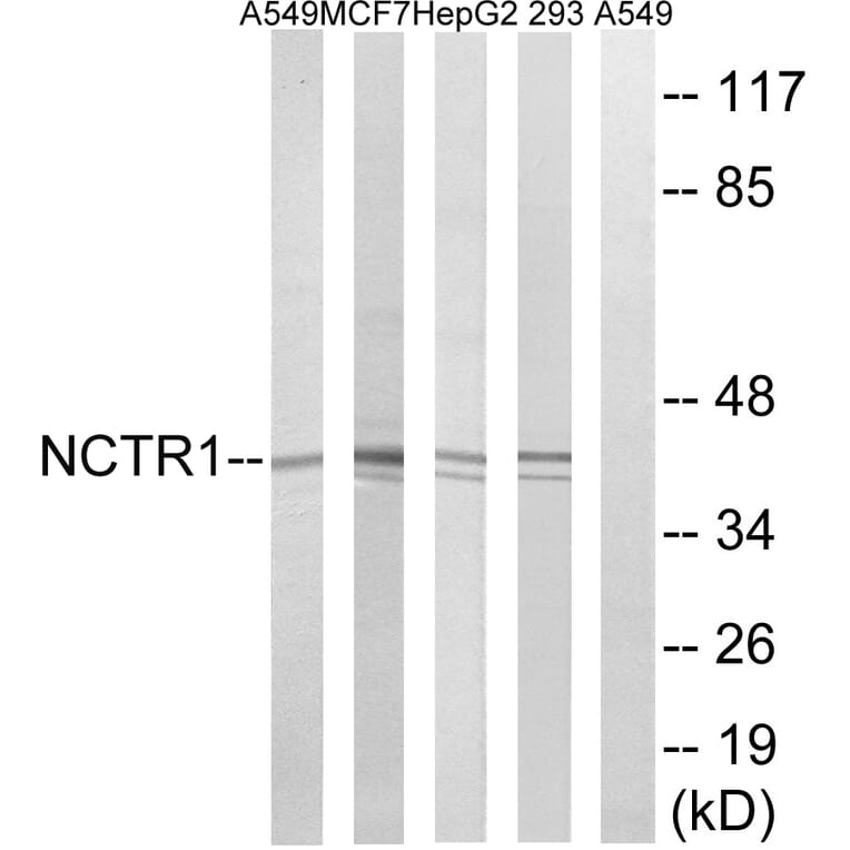 Western Blot - Anti-NCR1 Antibody (C16873) - Antibodies.com