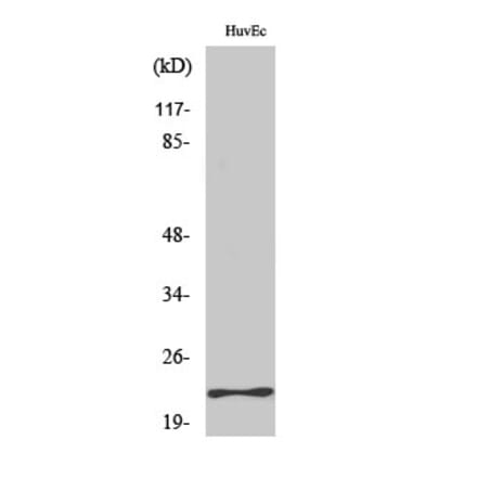 Western Blot - Anti-MYL3 Antibody (C20888) - Antibodies.com