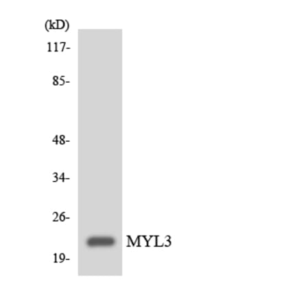 Western Blot - Anti-MYL3 Antibody (R12-3068) - Antibodies.com