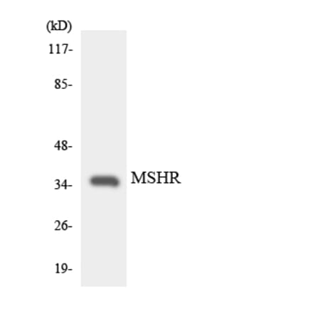 Western Blot - Anti-MSHR Antibody (R12-3057) - Antibodies.com