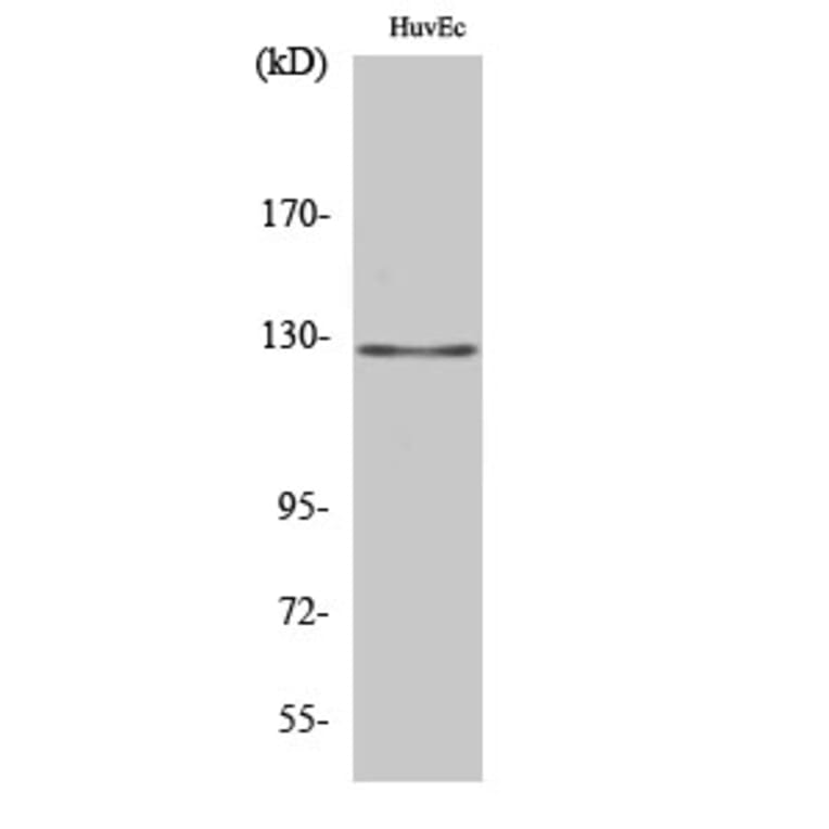 Western Blot - Anti-MSH3 Antibody (C13090) - Antibodies.com