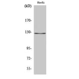 Western Blot - Anti-MSH3 Antibody (C13090) - Antibodies.com