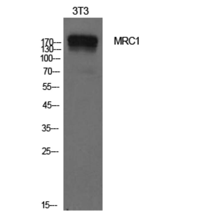 Western Blot - Anti-MRC1 Antibody (C30572) - Antibodies.com
