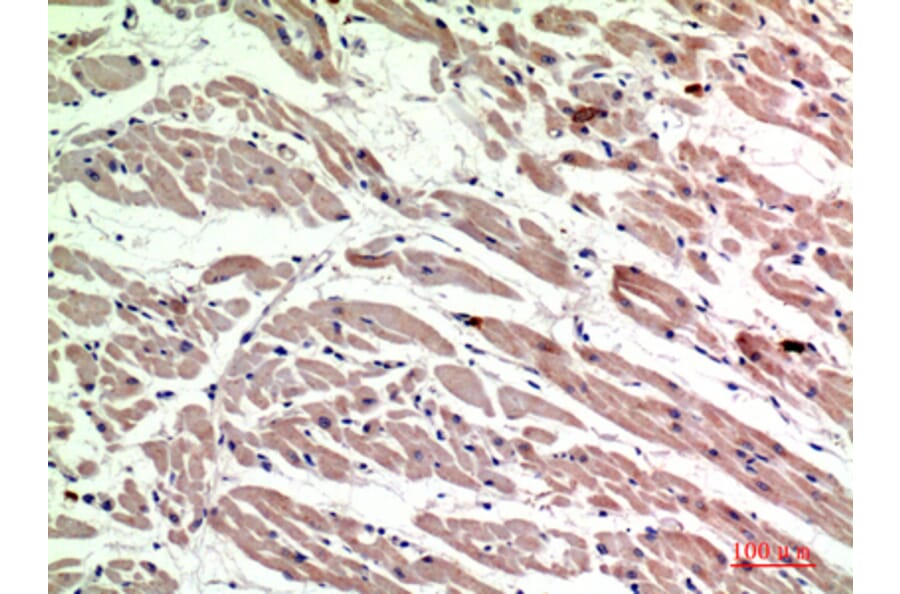 Immunohistochemistry - Anti-MRC1 Antibody (C30572) - Antibodies.com