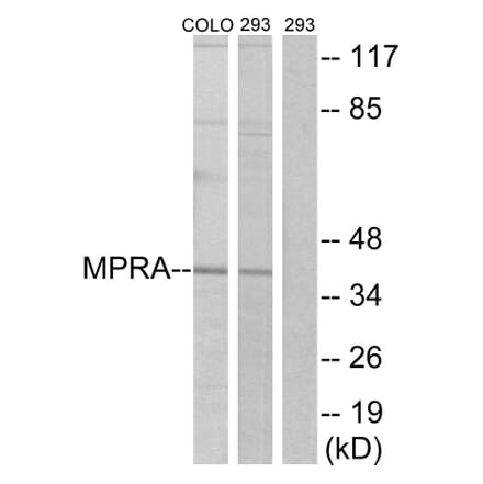 Western Blot - Anti-MPRA Antibody (G388) - Antibodies.com