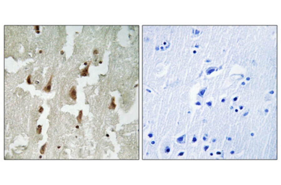 Immunohistochemistry - Anti-MNDA Antibody (C16747) - Antibodies.com
