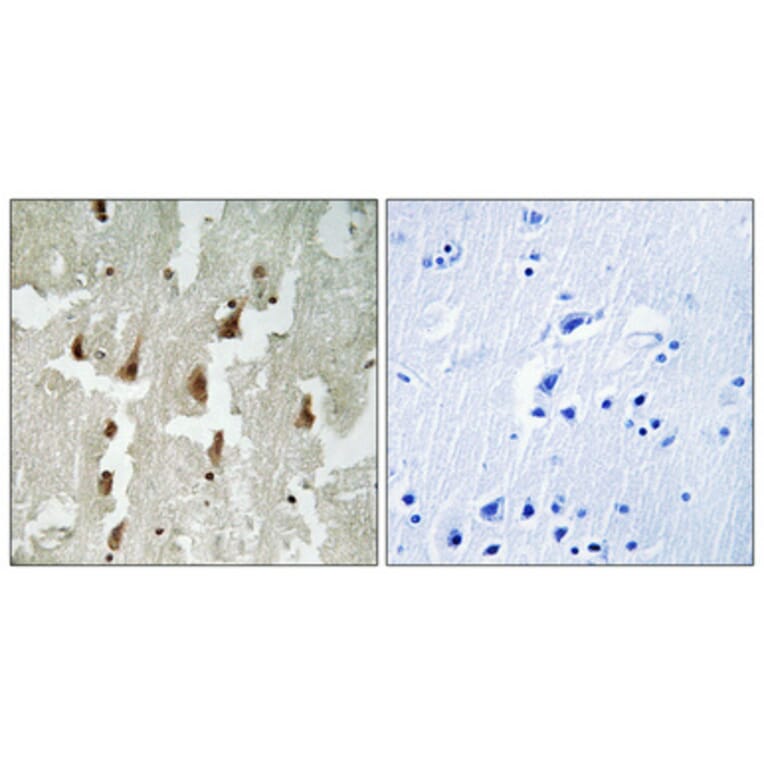 Immunohistochemistry - Anti-MNDA Antibody (C16747) - Antibodies.com